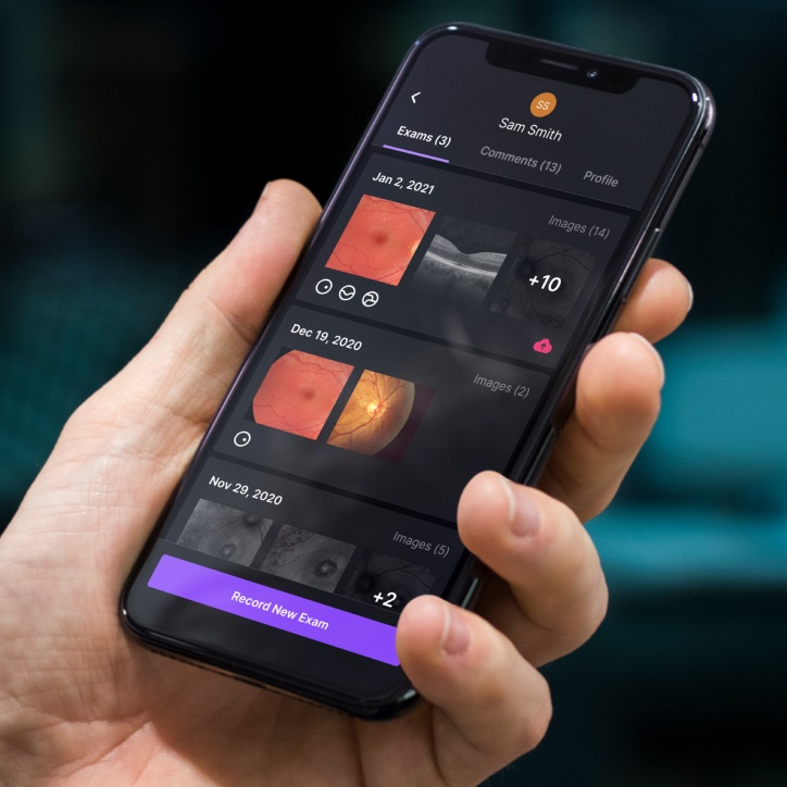 Identifeye Health retinal scanning device and app