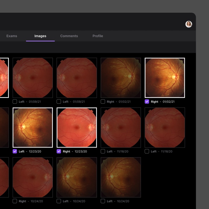 Image scan comparison grid in a diagnostic app