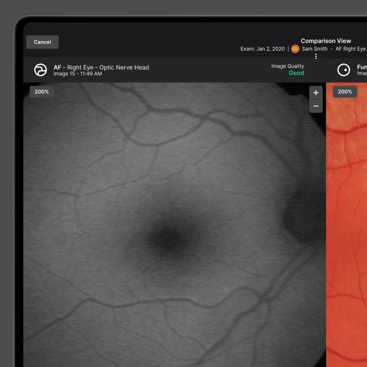 Retinal scan visualization screen